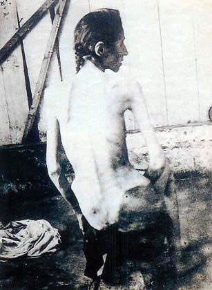 armenian woman tortured by turks